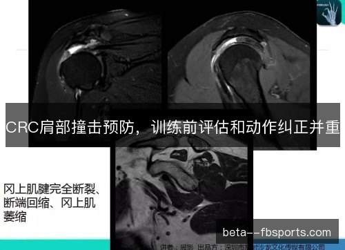 CRC肩部撞击预防,训练前评估和动作纠正并重 CRC肩部撞击预防,训练前评估和动作纠正并重